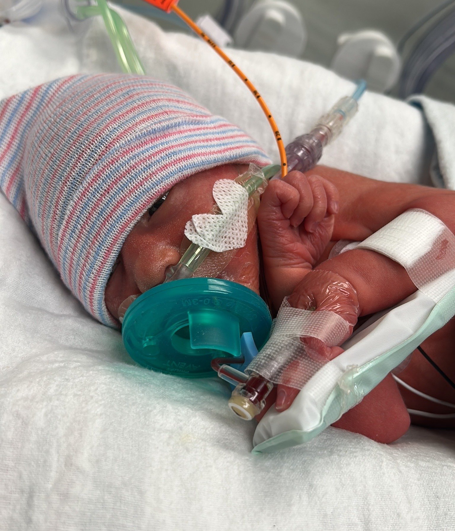 Support for baby Conor